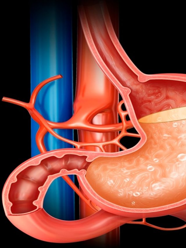 মশলাদার খাবার খেলেই চোঁয়া ঢেকুর- অ্যাসিডিটি? ওষুধ ছাড়াই সারবেন এভাবে