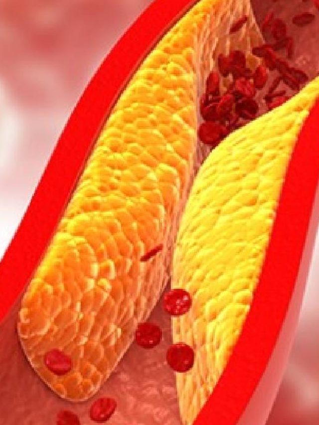 পাঁই পাঁই করে ছুটবে কোলেস্টেরল, এই সবজিতেই তাজা  হবে শরীর, জানুন