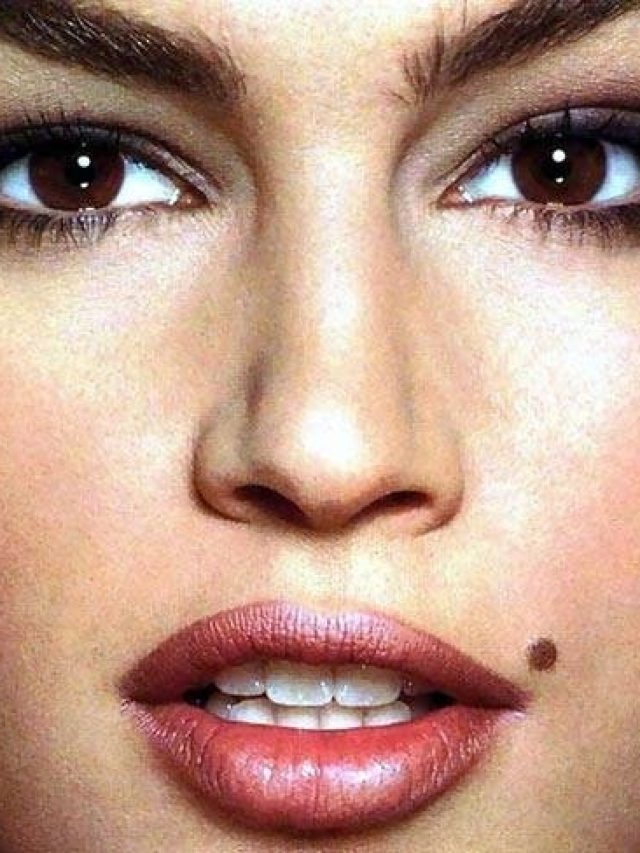 আপনারও এখানে তিল আছে? নিশ্চিন্তে থাকুন টাকা আসবেই