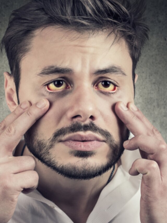 শরীরে রক্ত বাড়ায় এই ৭ খাবার, অ্যানিমিয়া হবে দূর: আয়ুর্বেদ