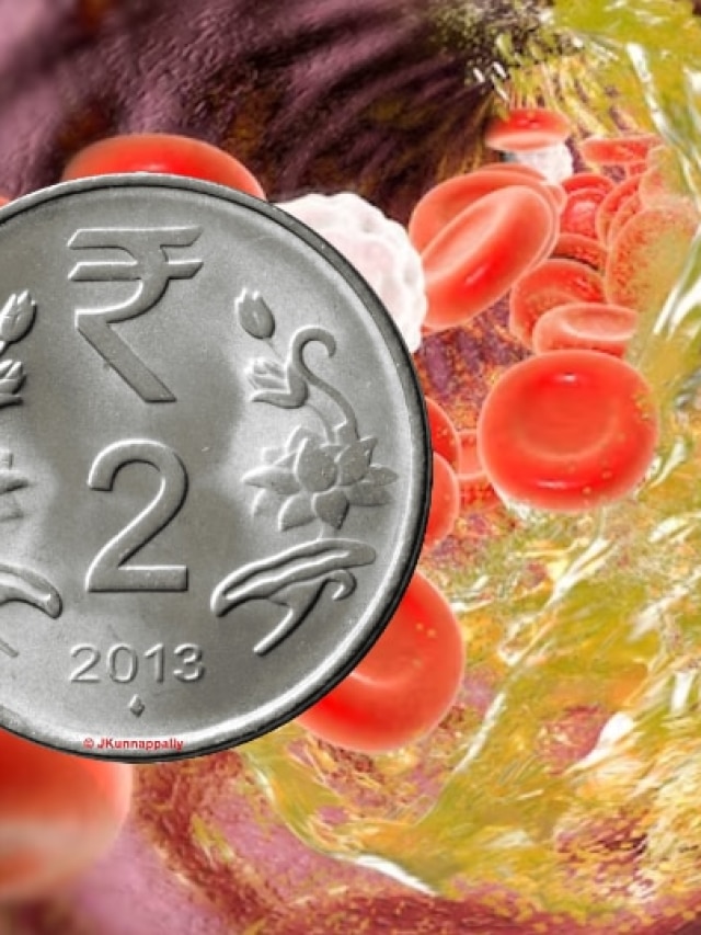 হাই কোলেস্টেরলও হু হু করে গলিয়ে দেবে মাত্র ২ টাকার এই দাওয়াই