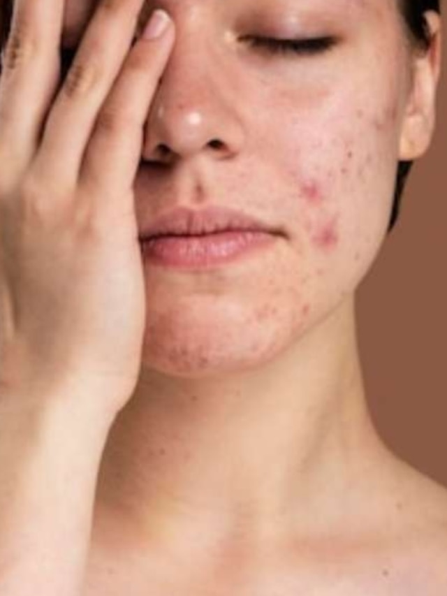 শরীরে কোলেস্টেরল বেড়েছে? ডাক্তার না দেখিয়েও কীভাবে বুঝবেন