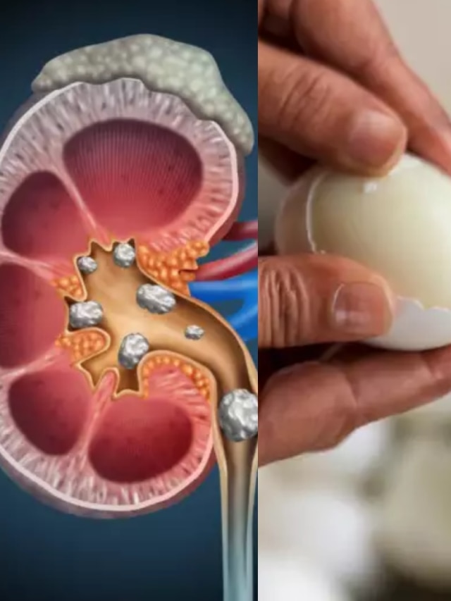 সময় থাকতে সাবধান! আপনার এই ৮ ভুলে খারাপ হচ্ছে কিডনি