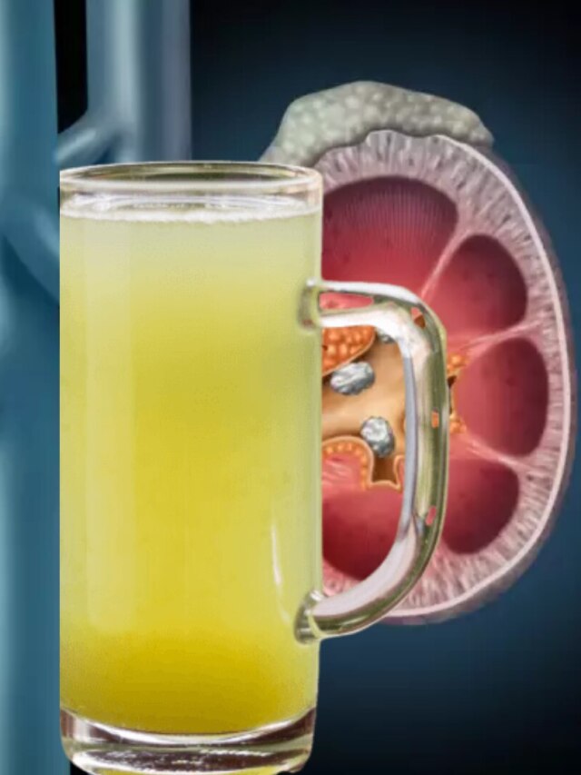 প্রস্রাব দিয়ে বেরোবে কিডনি স্টোন, গরমে খান এই ফলের রস