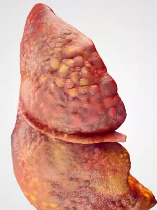 রোজ এই খাবার খেয়ে এভাবে ঝলসাচ্ছে লিভার,অকালেই বুড়ো