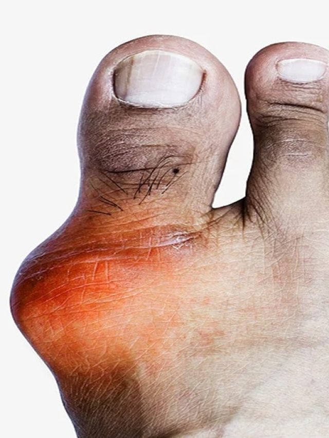 বাড়তি ইউরিক অ্যাসিড ফিল্টার করে এই সবজি! সুস্থ থাকতে জানা জরুরি