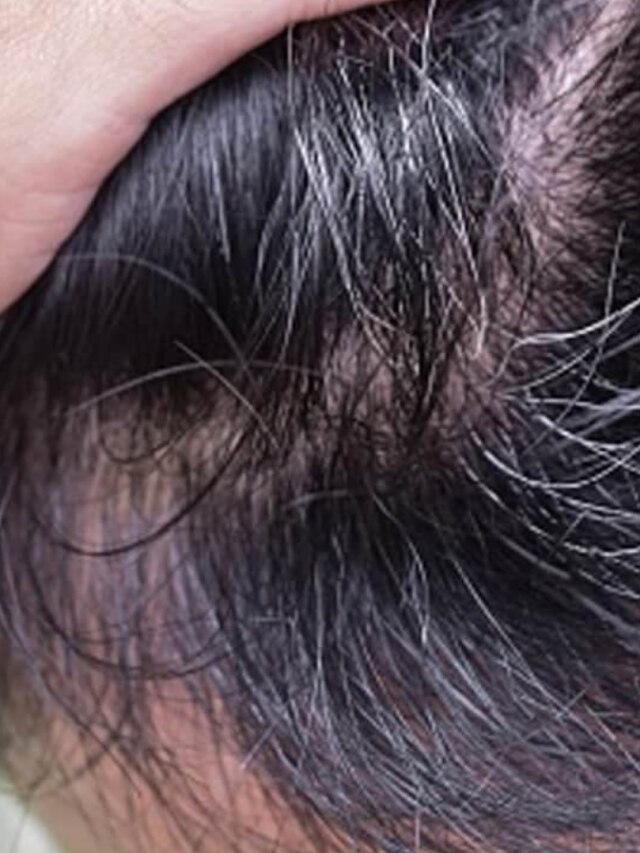 এই ৩ ভুলেই অকালে পাকছে চুল, ডাই করবেন না, এভাবে কালো করুন