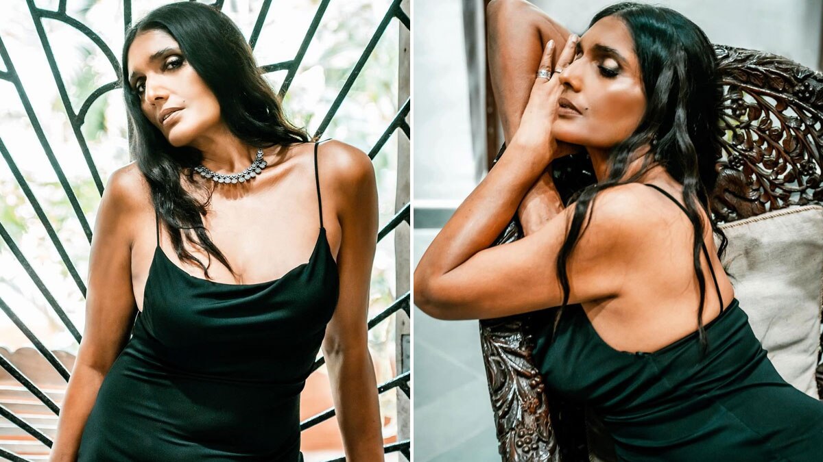 'मेरी शक्ल 100% नेचुरल', एक्सीडेंट के बाद बिगड़ा चेहरा, 'आशिकी गर्ल' ने कराई सर्जरी?