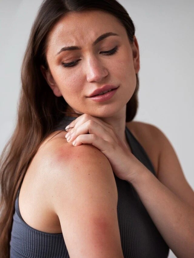 গরমে বাড়ছে ঘামাচি, ৩ টিপসেই মিলবে আরাম