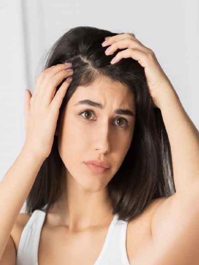 মাথায় উকুন হয়েছে নাকি? এই ৫ ঘরোয়া উপায়ে দূর করুন