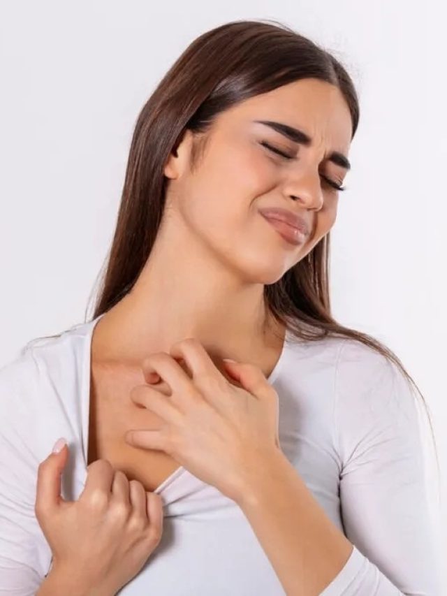 গরম পড়তেই দাদ,হাজা, চুলকানি জ্বালাচ্ছে? ছাড়ুন এই ৫ জিনিস খাওয়া