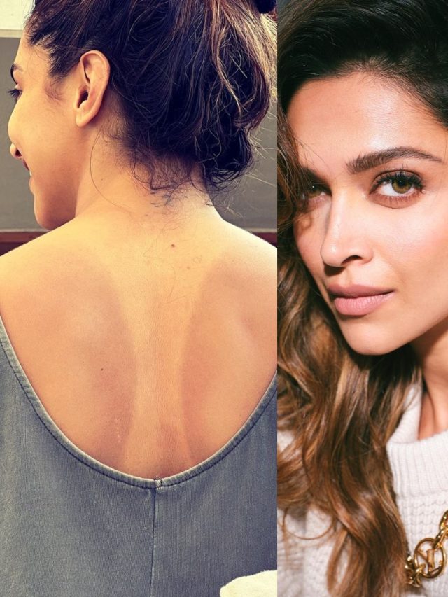 সমুদ্রে গিয়ে দীপিকার মতো ট্যানের শিকার ? জেনে নিন চটজলদি সমাধান