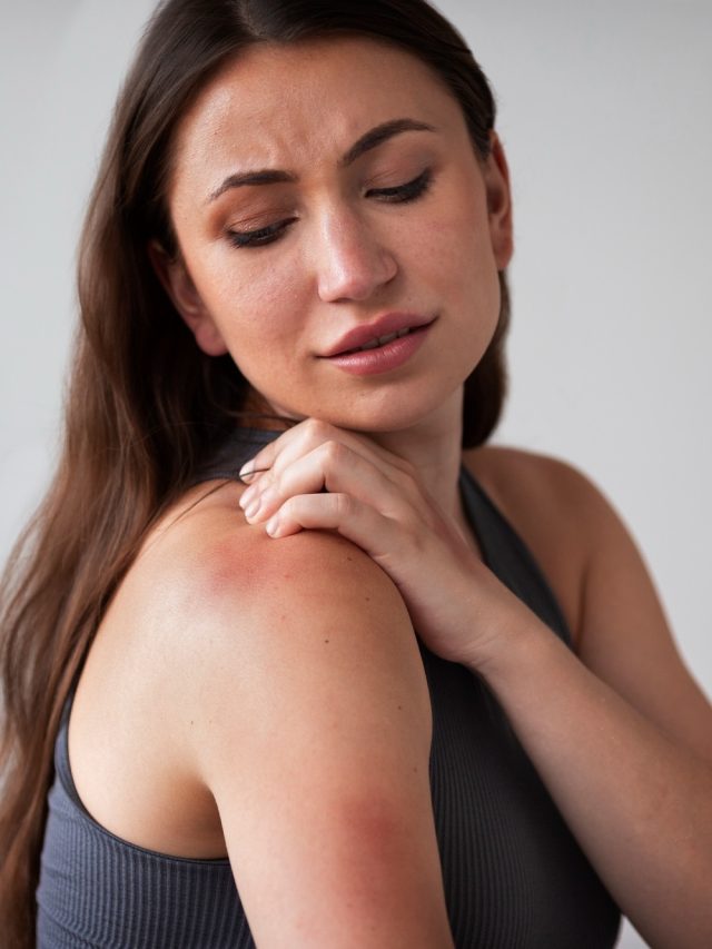 ঘামাচি শরীর ছুঁতে পারবে না, ৫ টোটকায় গরম কাটান নিশ্চিন্তে