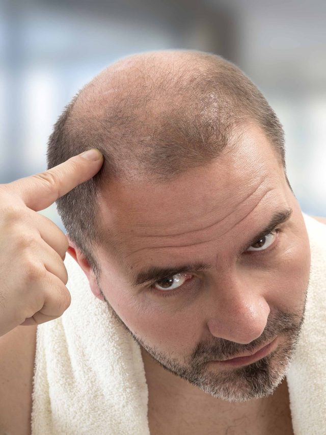 টাক মাথায় হু হু করে চুল গজাবে, এভাবে লাগান পেঁয়াজ