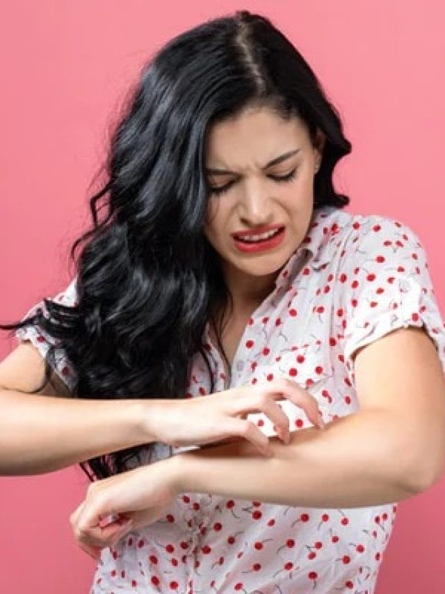 গরম পড়তেই ব়্যাশ-চুলকানি-অ্যালার্জি, নিমেষে নিপাত যাবে এই ম্যাজিকেই