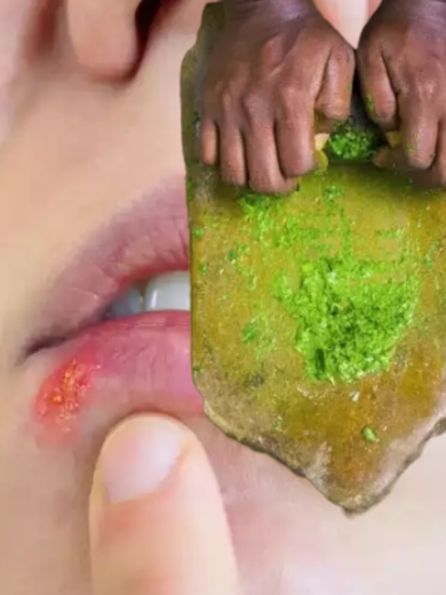 হারপিস থেকে চিরতরে মুক্তি, ভিতর থেকে ভাইরাস মারে ৫ ভেষজ: আয়ুর্বেদ