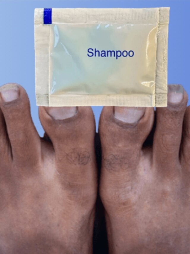 মাত্র ১ টাকার শ্যাম্পুতেই রোদে পোড়া হাত-পা চকচকে করুন, টিপস