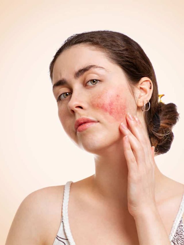 মুখে এই ৫ বদল দেখলেই সাবধান, হাই কোলেস্টেরলের লক্ষণ