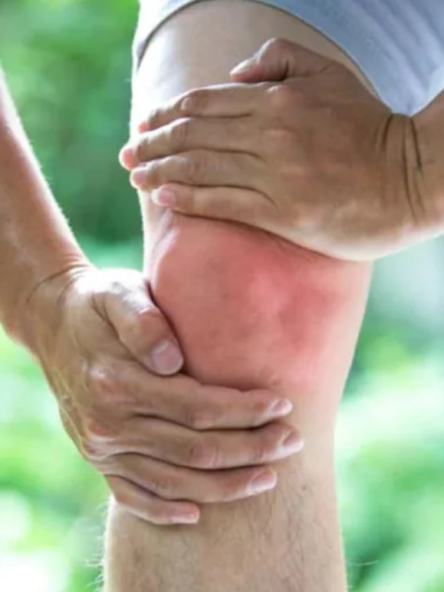 এইসব খাবারই বাড়াচ্ছে ইউরিক অ্যাসিড, মুখে তোলার আগে সাবধান!