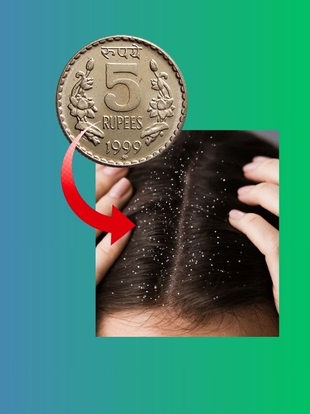 মাত্র ৫ টাকাতেই খুসকিকে 'টাটা' বলুন, চুল হবে সিল্কি, ঘন