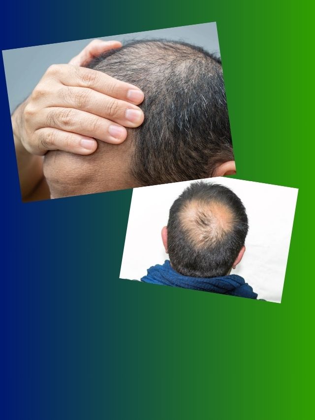 দিন দিন চুল পাতলা হয়ে যাচ্ছে? আজ থেকেই এগুলি অবশ্যই করুন