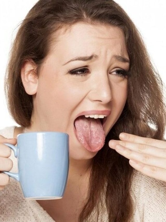 গরম জিনিস খেতে গিয়ে জিভ পুড়ে গিয়েছে? চটজলদি আরাম মিলবে, গোপন ট্রিকসে