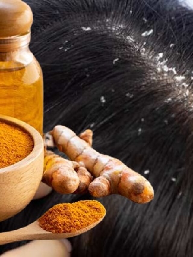 জীবনের মতো বিদায় হবে খুশকি, এভাবে কাজে লাগান হলুদ