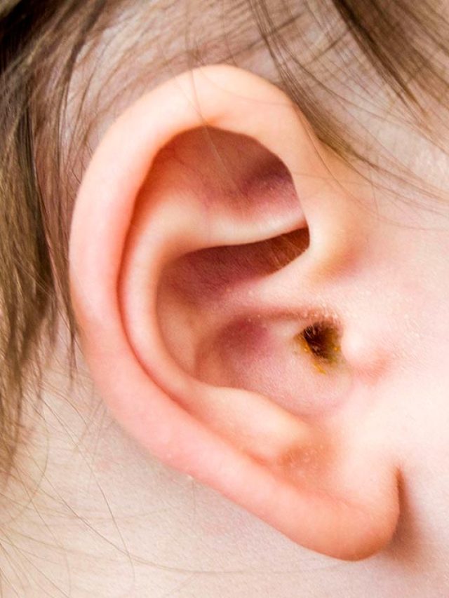 কানের খোল তো এবার বেড়িয়ে আসছে, একফোঁটা মাছের তেলেই সাফ হবে নোংরা