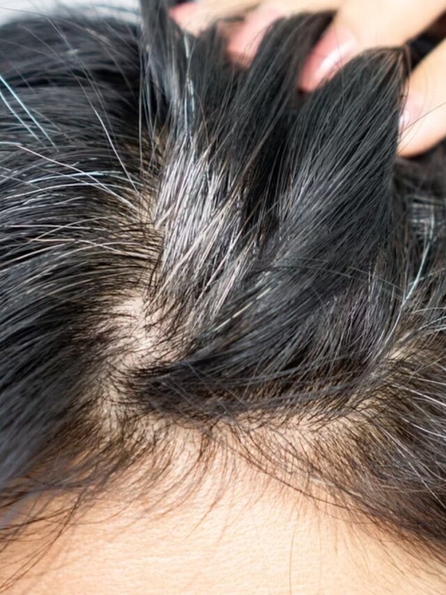 কম বয়সে পাকছে চুল?  নারকেল তেলে গরম করে দিন এই পাতা