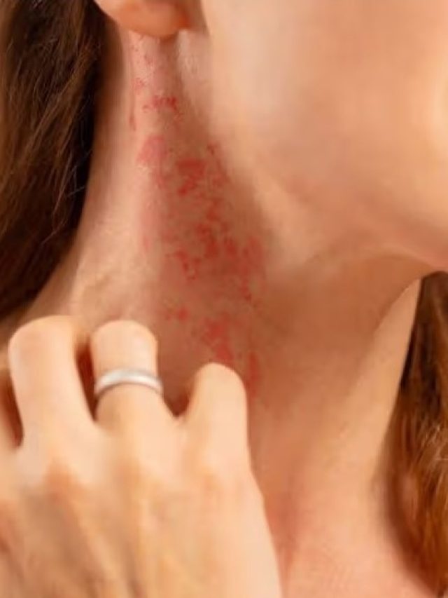 চুলকে চুলকে তো চামড়া তুলে ফেললেন, ভাজাভুজির এই মশলায় কমবে চুলকানি