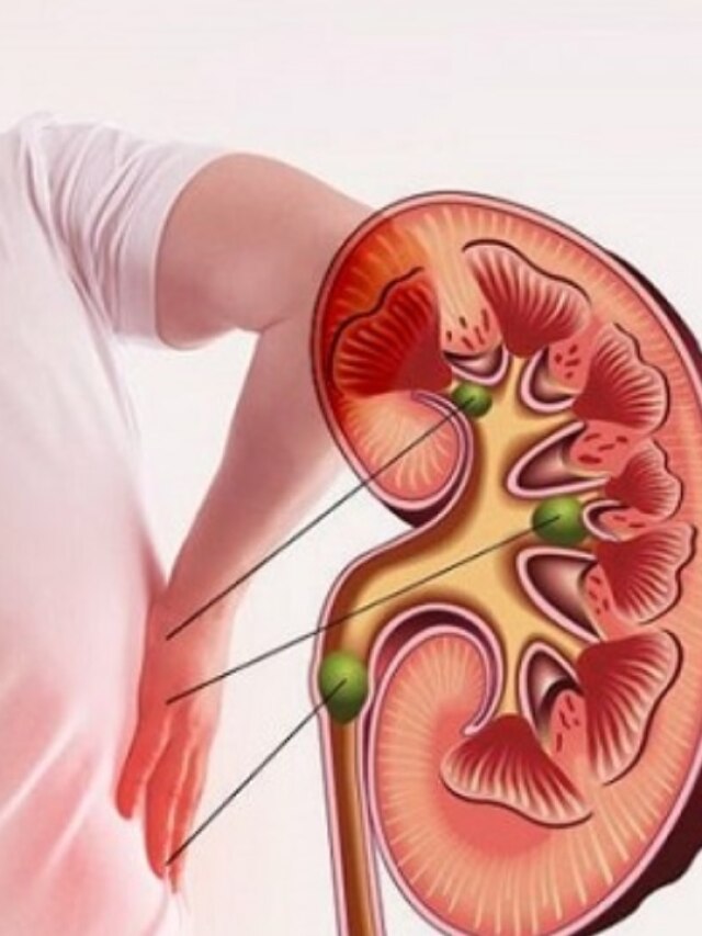 কিডনির জন্য 'বিষ' এই ৫ খাবার, ভুলেও বেশি খাবেন না