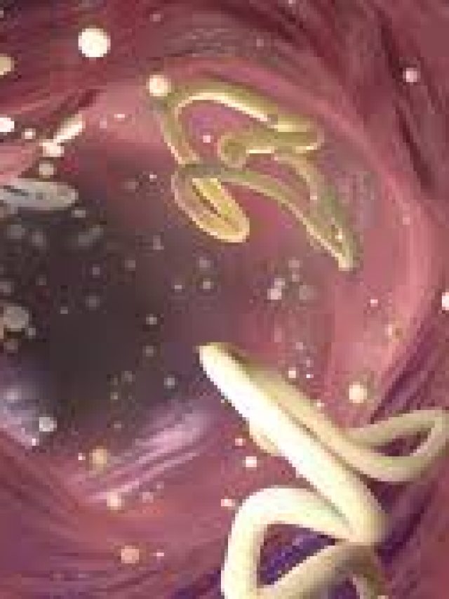 গা ঘিনঘিনে কৃমি বেরোচ্ছে পায়খানা থেকে? ঘেন্না পাওয়ার আগে তাড়ান এভাবে