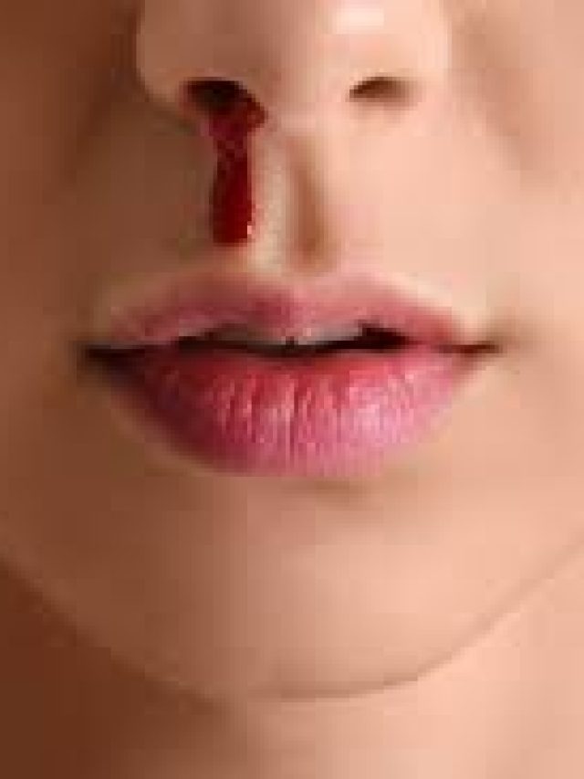 গলগল করে নাক থেকে রক্ত পড়ছে? কিছু হয়নি বলে এড়িয়ে যাবেন না