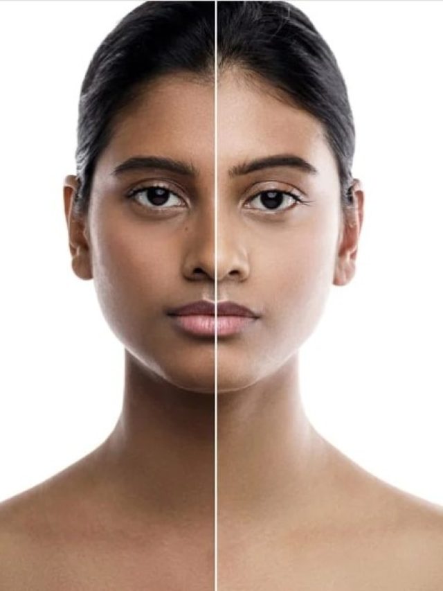 রোদে পুড়ে ট্যান পড়ে যা তা কাণ্ড! ত্বকের কালচে রং তুলতে লাগবে মাত্র ৯ টাকা