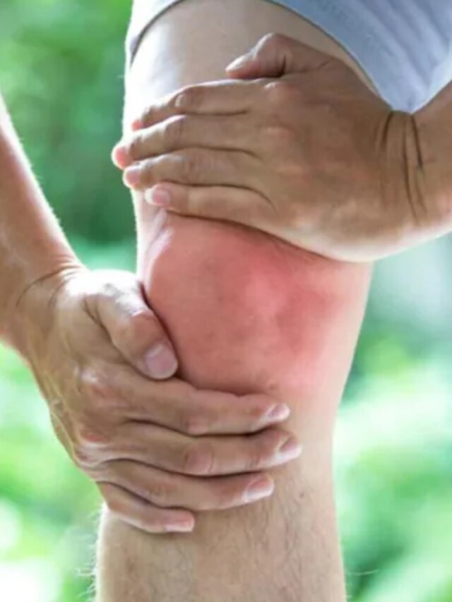 প্রস্রাব দিয়ে বের হবে ইউরিক অ্যাসিড, রোজ খান এই সবুজ ফল