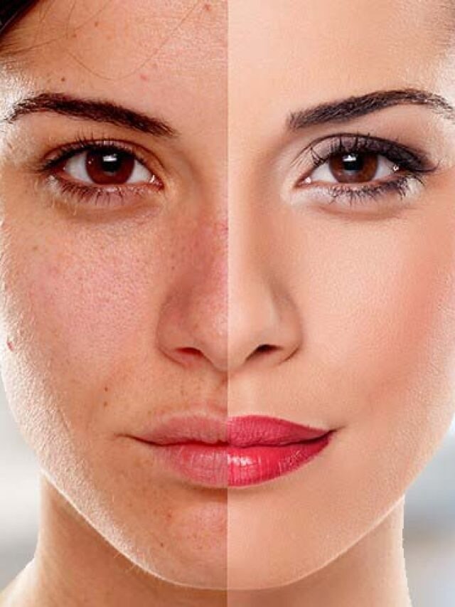 বয়স কমবে অনেকগুন, ত্বক টানটান রাখতে খান এই ফল