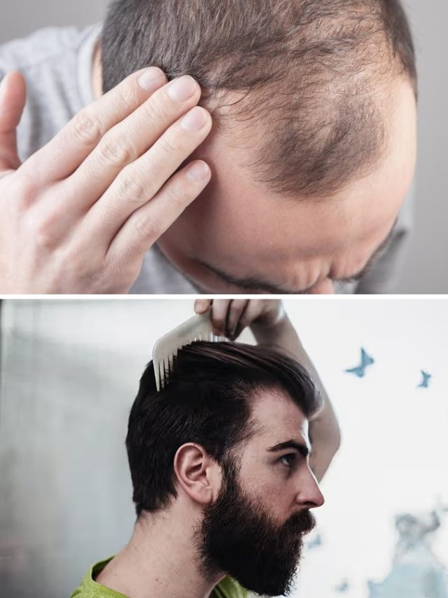 টাক মাথাতেও ভরবে চুল, এই সাধারণ মশলাতেই হবে কাজ