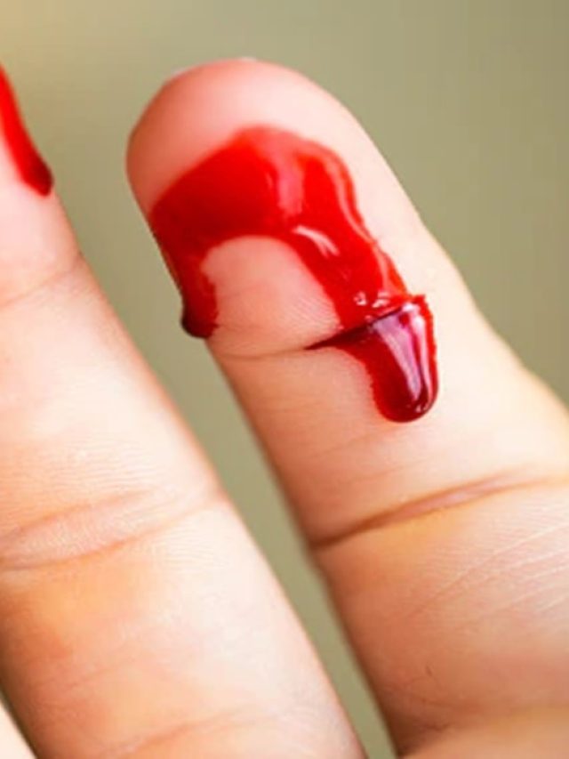 রক্তে ভয়? দেখলেই মাথা ঘোরে? আপনি এই রোগে ভুগছেন তাহলে!