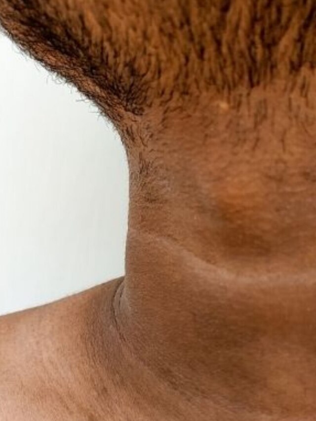 ঘাড়-গলার চিটচিটে ময়লা দূর হবে নিমেষে, লাগান এই ফলের খোসা