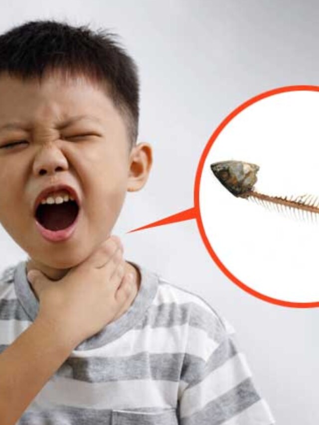 বাচ্চার গলায় আটকে মাছের কাঁটা? এই ট্রিকসে সঙ্গে সঙ্গে বেরোবে