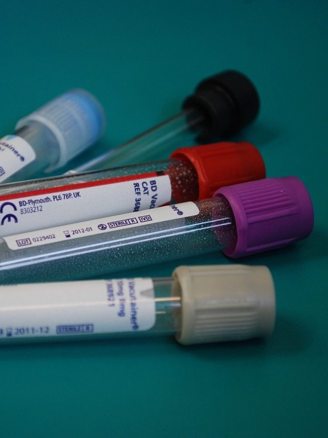 বয়স ৩৫ পেরেলো যে টেস্ট করতেই হবে, ডাক্তারের পরামর্শ