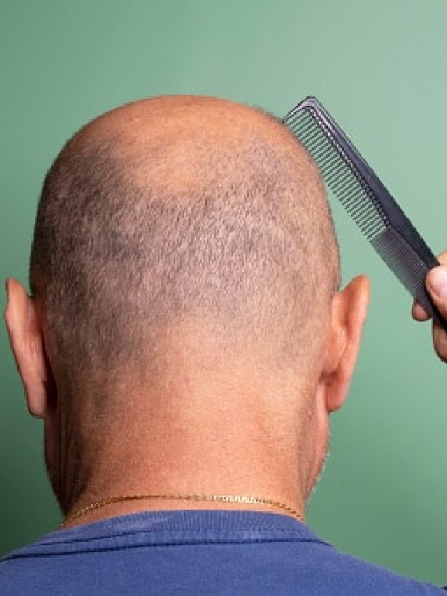 এই রসের ২ ফোঁটা মালিশে হবে চুলের চাষ, টাক ভরাতে অব্যর্থ