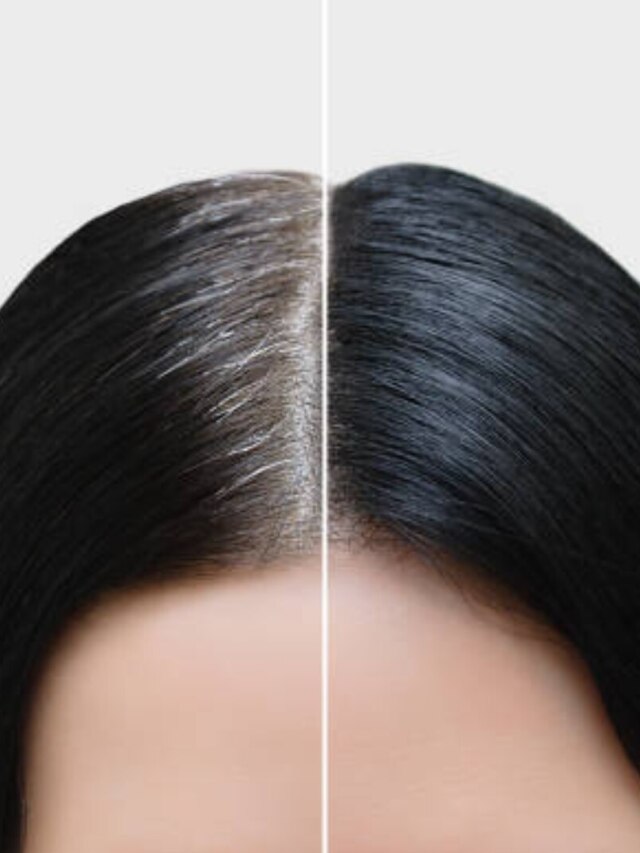 ডাই করে টানা ৬ মাস কালো থাকবে পাকা চুল, এই ট্রিকসটা জেনে নিন