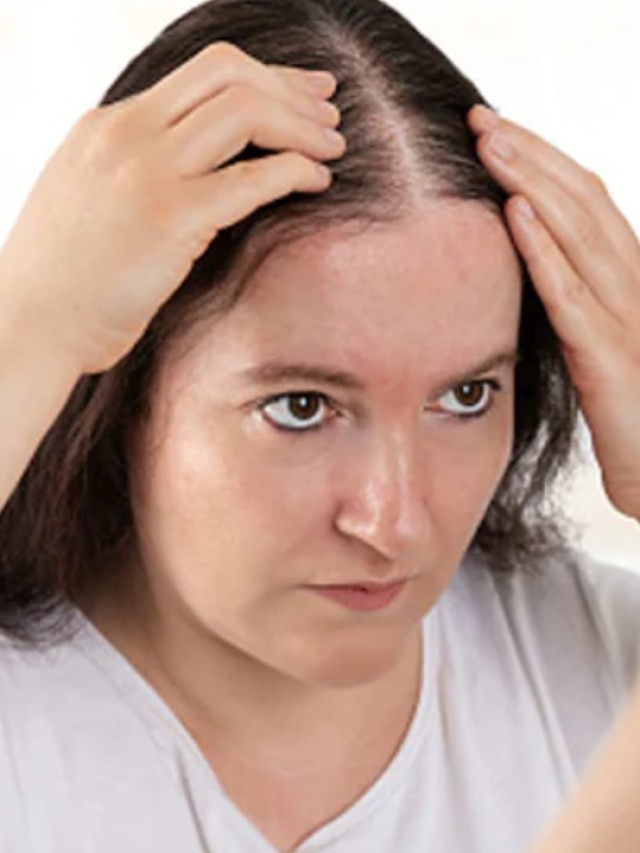 ফাঁকা টাকে গজাবে গুঁড়ি গুঁড়ি চুল, মাখুন এই সস্তার জিনিস