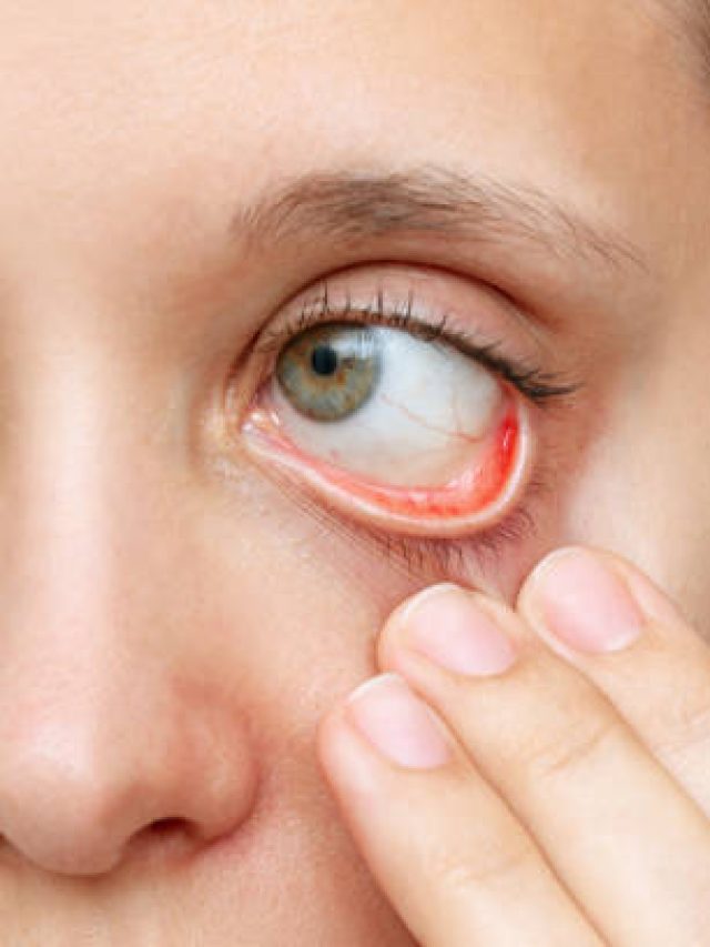 শিরায় শিরায় রক্ত খেলা করবে, হিমোগ্লোবিন বাড়াতে পেটে পুরুন লাল সবজি