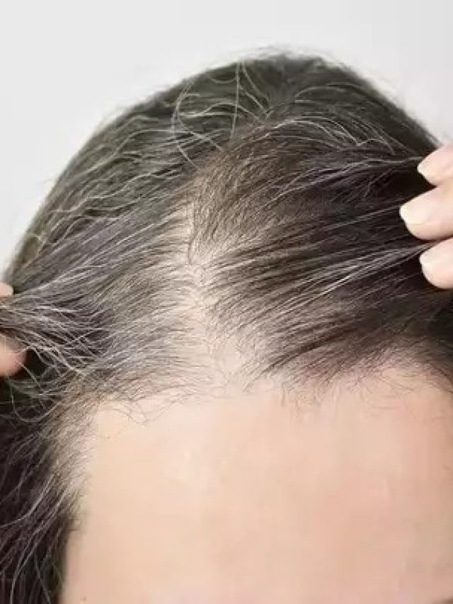 চুল উঠে টাক উঁকি দিচ্ছে? এই জুসেই ফের কালো কেশে ভরবে মাথার বাগান