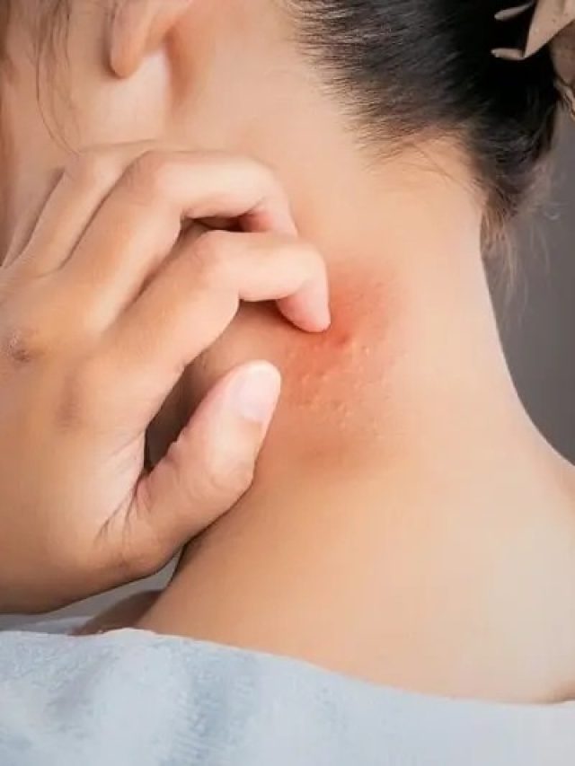 বর্ষার দাদ-হাজা-চুলকানি আর জ্বালাবে না, ঝাড়ে বংশে নির্মূলের জব্বর টোটকা