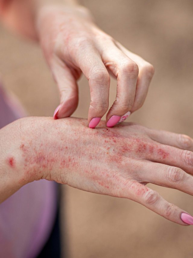 হাতে ডলে নিন এই তেল, গুচ্ছের জল ঘাটলেও হাজা হবে না