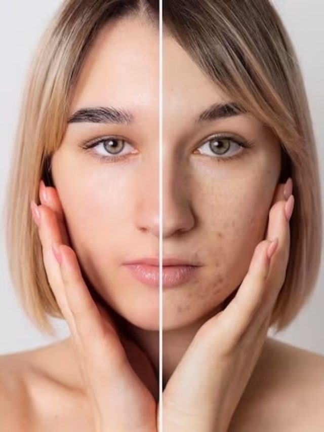 ৪০-এও মুখের ত্বক থাকবে টানটান, খান এই ফল