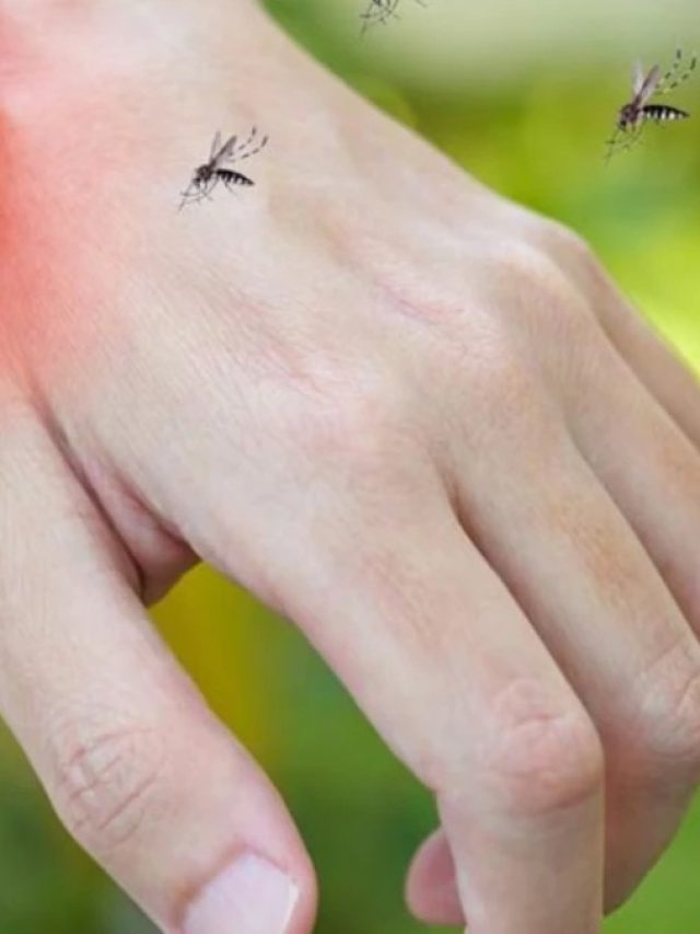 যত মশা আপনাকেই ধরে? আজ থেকে আর ধরবে না